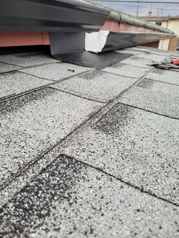Shingles